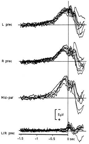 Typical recording of the Bereitschaftspotential that was discovered by Kornhuber and Deecke in 1965.