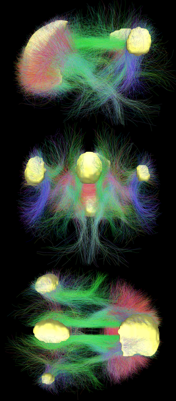 Default mode network connectivity.