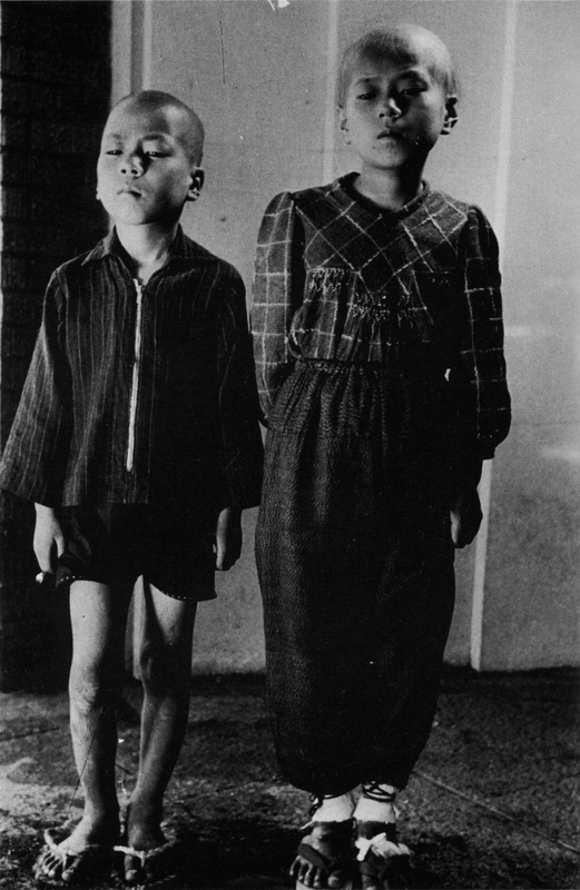 Elder sister and younger brother who lost their hair by aftereffects of atomic bomb.