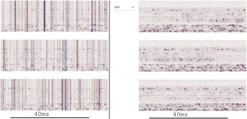 Figure 3 (panel a) from Alessio P. Buccino et al. (2025) shows the output of the visualization and quality control stage in a modern large-scale spike sorting pipeline.