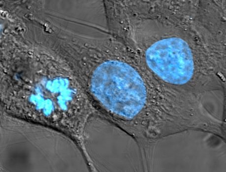 HeLa cells stained with Hoechst.