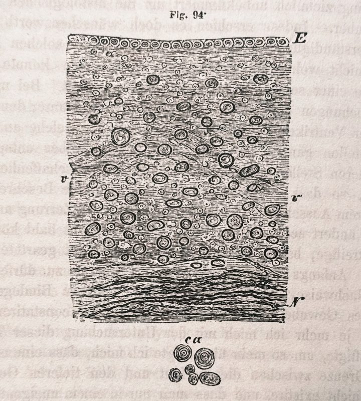 Woodcut illustration of the ependyma of the ventricles and neuroglia from the floor of the fourth ventricle.